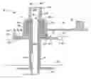 Fig. 01 - Medical catheter assembly including a removable inner sleeve and method of using the same