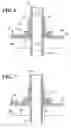 Fig. 05 - Medical catheter assembly including a removable inner sleeve and method of using the same