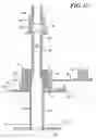 Fig. 09 - Medical catheter assembly including a removable inner sleeve and method of using the same