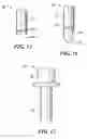 Fig. 11 - Medical catheter assembly including a removable inner sleeve and method of using the same
