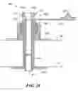 Fig. 12 - Medical catheter assembly including a removable inner sleeve and method of using the same