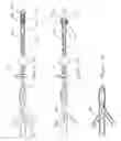 Fig. 06 - Method and apparatus for chest drainage