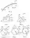 Fig. 03 - Medical needles and electrodes with improved bending stiffness