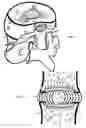 Fig. 02 - Injection device for the invertebral disc