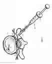 Fig. 07 - Injection device for the invertebral disc