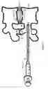 Fig. 09 - Injection device for the invertebral disc