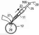 Fig. 01 - Temporary seal and method for facilitating anastomosis