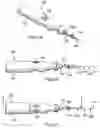 Fig. 02 - Tissue removal apparatus