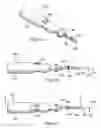 Fig. 02 - Tissue removal apparatus