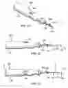 Fig. 02 - Tissue removal apparatus