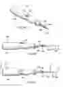 Fig. 02 - Method for removing material from a patient's body