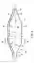 Fig. 04 - Balloon structure and balloon catheter
