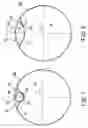 Fig. 07 - Balloon structure and balloon catheter
