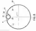 Fig. 08 - Balloon structure and balloon catheter