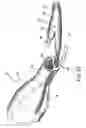 Fig. 22 - Balloon structure and balloon catheter