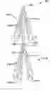 Fig. 01 - Intravascular filter assembly