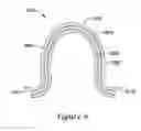 Fig. 06 - Intravascular filter assembly