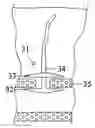 Fig. 01 - Medical sealing device