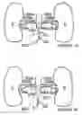 Fig. 09 - Methods and apparatus for treating acute myocardial infarction
