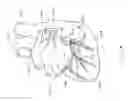 Fig. 07 - Integrated lead for applying cardiac resynchronization therapy and neural stimulation therapy