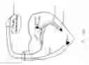 Fig. 08 - Integrated lead for applying cardiac resynchronization therapy and neural stimulation therapy