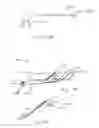 Fig. 13 - Integrated lead for applying cardiac resynchronization therapy and neural stimulation therapy