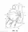 Fig. 04 - Neural stimulation system for cardiac fat pads
