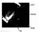 Fig. 01 - Miniaturized high-density multichannel electrode array for long-term neuronal recordings