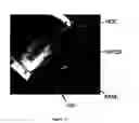 Fig. 02 - Miniaturized high-density multichannel electrode array for long-term neuronal recordings