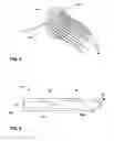 Fig. 04 - Implantable neurostimulator device