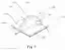 Fig. 07 - Device for percutaneous nerve stimulation