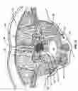 Fig. 04 - Percutaneous endoscopic access tools for the spinal epidural space and related methods of treatment