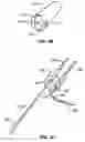 Fig. 06 - Percutaneous endoscopic access tools for the spinal epidural space and related methods of treatment