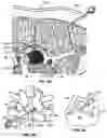 Fig. 14 - Percutaneous endoscopic access tools for the spinal epidural space and related methods of treatment
