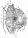 Fig. 16 - Percutaneous endoscopic access tools for the spinal epidural space and related methods of treatment