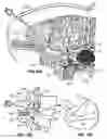 Fig. 20 - Percutaneous endoscopic access tools for the spinal epidural space and related methods of treatment
