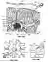 Fig. 29 - Percutaneous endoscopic access tools for the spinal epidural space and related methods of treatment