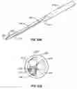 Fig. 33 - Percutaneous endoscopic access tools for the spinal epidural space and related methods of treatment