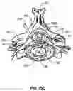Fig. 37 - Percutaneous endoscopic access tools for the spinal epidural space and related methods of treatment