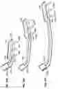 Fig. 40 - Percutaneous endoscopic access tools for the spinal epidural space and related methods of treatment
