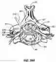 Fig. 46 - Percutaneous endoscopic access tools for the spinal epidural space and related methods of treatment