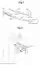 Fig. 05 - Subcutaneous electrode with improved contact shape for transthoracic conduction