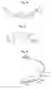 Fig. 07 - Subcutaneous electrode with improved contact shape for transthoracic conduction