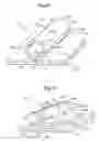 Fig. 22 - Subcutaneous electrode with improved contact shape for transthoracic conduction