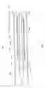 Fig. 09 - BALLOON CATHETER FOR MULTIPLE ADJUSTABLE-LENGTH STENT DEPLOYMENT