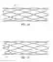 Fig. 07 - Stent with cover connectors