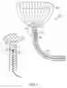 Fig. 02 - Device for closure of a vascular defect and method for treating the same