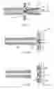 Fig. 05 - Device for closure of a vascular defect and method for treating the same