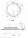 Fig. 04 - Endovascular balloon graft
