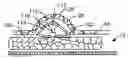 Fig. 01 - ANEURYSM TREATMENT DEVICES